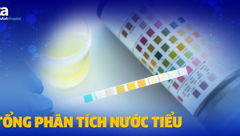 Tổng phân tích nước tiểu là gì? Ý nghĩa 10 thông số xét nghiệm